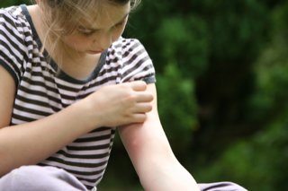 Mosquito Bite, Fort Worth